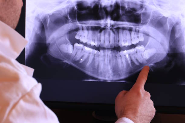 Best Emergency Broken Tooth Repair in Ripon, WI